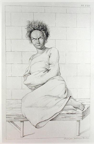Woman in a straitjacket, illustration for Des Maladies Mentales considerees sous le rapport medical, hygienique et medico-legal, by Etienne Esquirol 1772-1840, 1838
