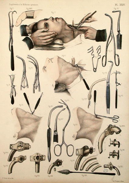 Tracheotomy operation, plate from Traite Complet de lAnatomie de lHomme by Jean-Baptiste Marc Bourgery 1797-1849 1866-67 2