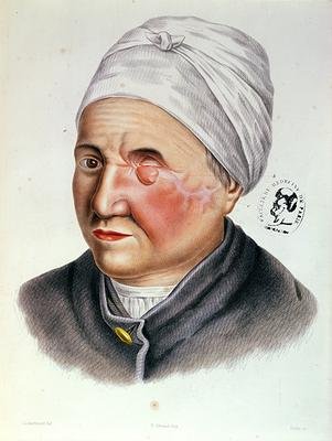 Illustration from Traite de Chirurgie Plastique